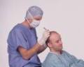 Hair Transplant Procedures For Young Men - Information Resource